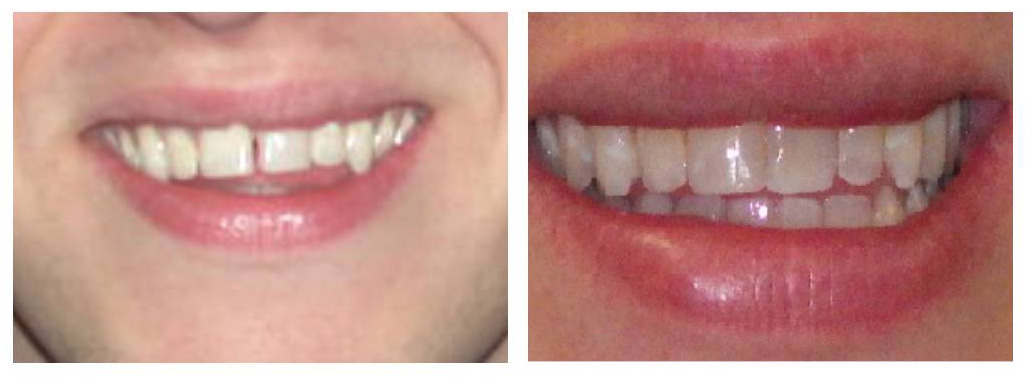 A Few Before and After Pics of Our Patients