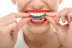Trik untuk Gigi yang Lebih Putih- Global Estetik Dental Care